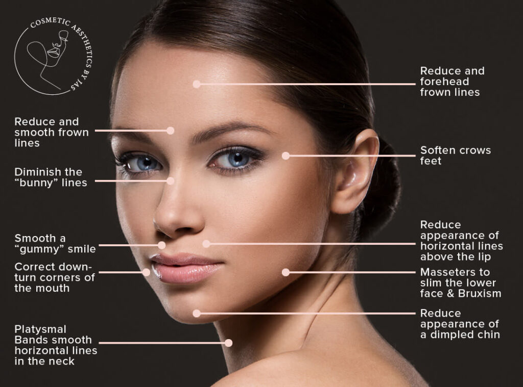 Cosmetic-Aesthetics-By-Jas-Antiwrinkle-Injections-Benefits